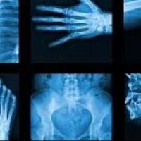 7-benda-aneh-dalam-tubuh-yang-tertangkap-oleh-sinar-x--ray