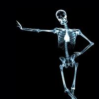 x-ray-dan-cara-kerjanya