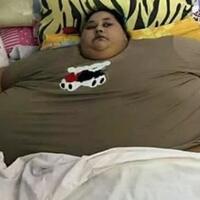 siapa-sangka-wanita-cantik-dan-seksi-ini-pernah-operasi-bariatrik