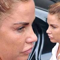 7-operasi-plastik-artis-luar-yang-berakhir-mengerikan--nomor-7-ngerii