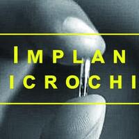 pernah-membayangkan-implan-microhip-pada-tubuh-warga-swedia-sudah-melakukannya