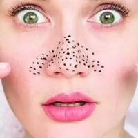 jangan-asal-bersihkan-komedo-jika-gak-mau-terjadi-hal-ini