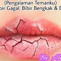 sulam-bibir-gagal-bibir-bengkak--bernanah-pengalaman-teman