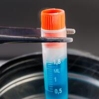 sulit-temukan-pasangan-hidup-sel-telur-pun-dibekukan