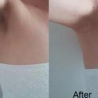 tips-memutihkan-ketiak-dengan-bahan-bahan-dapur