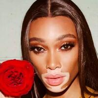 model-berkulit-belang-nangis-karena-didapuk-jadi-victorias-secret-angel