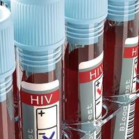 6-cara-melindungi-diri-dari-penularan-hiv-aids