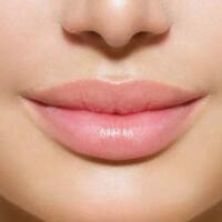 tips-merawat-kulit-bibir-yang-tipis-dan-sensitif