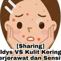sharing-aldys-vs-kulit-kering-berjerawat-dan-sensitif
