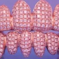 rapper-ini-habiskan-rp445-juta-untuk-pasang-500-berlian-di-gigi