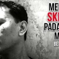 mengenal-skin-tag-benjolan-selain-tahi-lalat-yang-tidak-berbahaya