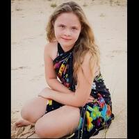 siapa-sangka-model-cantik-asal-brazil-ini-sebenarnya-adalah-penderita-down-syndrome