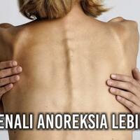 awas-berbahaya-kenali-lebih-lanjut-mengenai-anoreksia