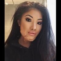 sophie-lee-model-cantik-asal-inggris-dengan-bekas-luka-bakarnya