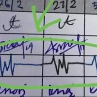 viral-tanda-tangan-seperti-denyut-nadi