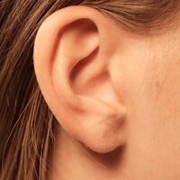 bisa-dicoba-ini-4-tips-mengeluarkan-serangga-di-telinga