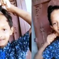 mengerikan-kulit-bocah-ini-bisa-melar-seperti-monkey-d-luffy-di-anime-one-piece