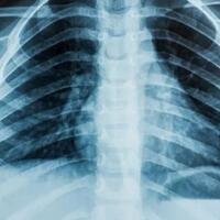 berumur-panjang-hingga-terlahir-kuat-berikut-mutasi-genetik-langka-yang-menakjubkan