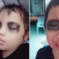 viral-mata-panda-hentikan-candu-smartphone-ternyata-tak-baik-untuk-anakmu