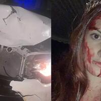 duh-gadis-cantik-alami-kecelakaan-mobil-pakai-kostum--hantu--warga-malah-takut