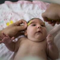 waspada-kelainan-pada-bayi-kenali-dan-cegah-penyakit-mikrosefali-sejak-dini