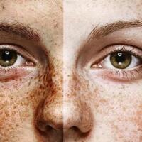 hati-hati-konsumsi-narkoba-bisa-memperburuk-kondisi-wajahmu