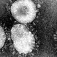 apa-sih-coronavirus-dan-bagaimana-cara-pencegahannya