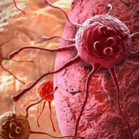 top-5-jenis-kanker-yang-lebih-banyak-membunuh-manusia