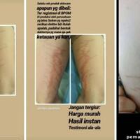 akibat-krim-pemutih-abal-abal-yang-dibeli-online-wanita-ini-alami-hal-mengerikan