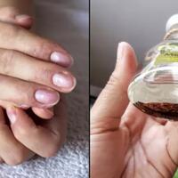 penggunaan-hand-sanitizer-bikin-kulit-tanganmu-kering-lakukan-ini-aja-sis