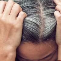 masih-berusia-20-an-tapi-rambut-sudah-ubanan-ini-penyebabnya