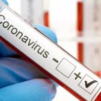 akhirnya-antivirus-corona-made-in-ri-resmi-dipatenkan
