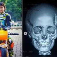 bibit-lady-racer-luka-parah-saat-latihan-mini-gp-mereka-butuh-donasi