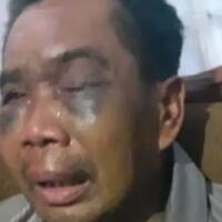 habis-digebuki-diinjak-dan-disiksa-polisi-kuli-bangunan-sarpan-disetrum