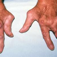 dunia-kesehatan-memasuki-babak-baru-dengan-rekayasa-genetika-untuk-kesembuhan