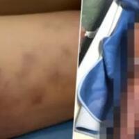 viral-tagar-keadilanuntukhendri-pria-malang-yang-meninggal-usai-dijemput-polisi