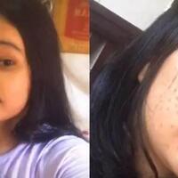 tren-prank-filter-jerawat-menguji-kesetiaan-pasangan-lo