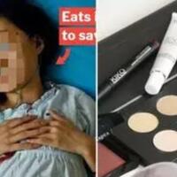 jor-joran-nabung-demi-miliki-produk-skincare-wanita-ini-divonis-penyakit-mengerikan