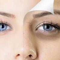 punya-mata-panda-yang-susah-dihilangkan-coba-cara-cara-ini-deh