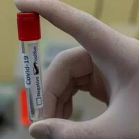 dianggap-lebih-akurat-deteksi-covid-19-china-pakai-metode-swab-anal
