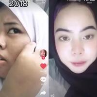 rahasia-remaja-glow-up-dalam-2-tahun-bikin-penasaran-dulu-jerawatan-kini-mulus