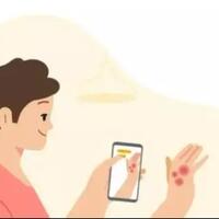google-memperkenalkan-fitur-yang-mendiagnosis-kondisi-kulit-dengan-mengambil-gambar