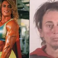 tragis-over-dosis-steroid-tampilan-binaragawati-ini-jadi-mengerikan