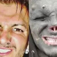pria-ini-rela-motong-hidung-dan-bibirnya-demi-mirip-black-alien