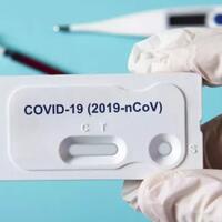 yuk-bahas-tentang-tes-pcr-covid-di-sini