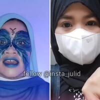 kisah-inspiratif-konten-kreator-tik-tok-yang-dihujat-karena-gigi-kuning-alasannya
