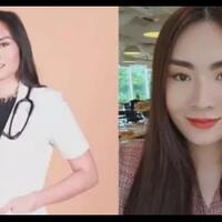 kisah-dokter-transgender-pertama-di-indonesia-dianggap-lebih-empati-ke-pasien