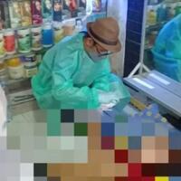 gara-gara-pengen-punya-paydara-pria-ini-meninggal-dalam-keadaan-dada-membesar
