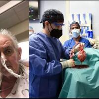 masih-ingat-manusia-transplantasi-jantung-babi-pertama-ia-telah-meninggal-dunia