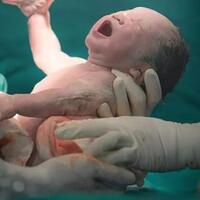 bayi-berselimut-lemak-saat-habis-lahir-jangan-salahkan-ibunya-pahami-vernix-caseosa